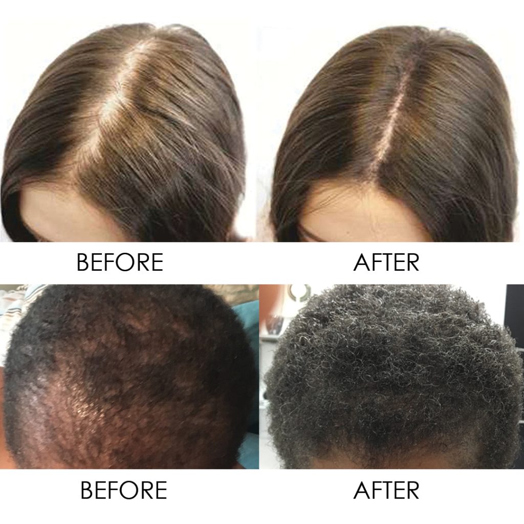 CBD Oil For Hair Before And After