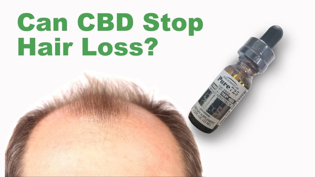Can CBD Stop Hair Loss